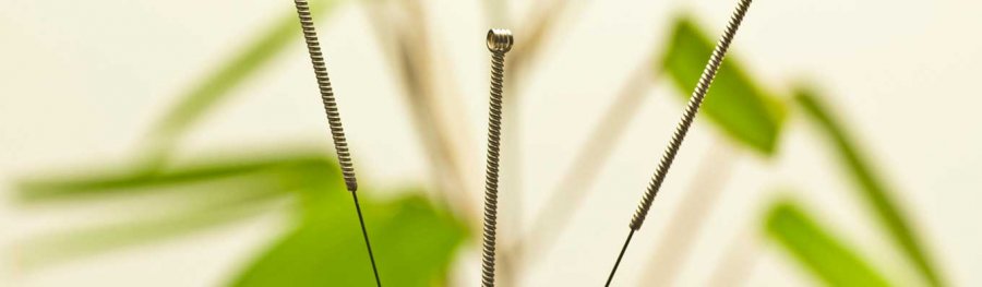 8 Ways to Make the Most of Your Acupuncture Treatments