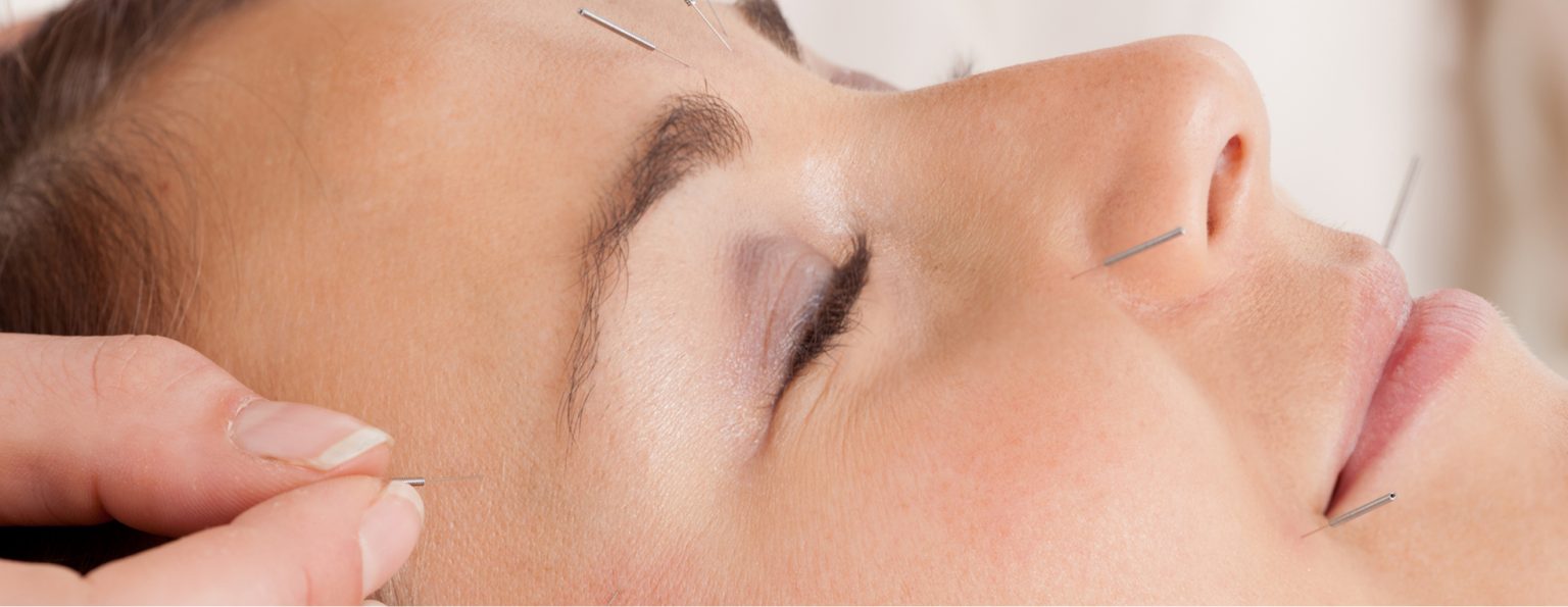 Facial Rejuvenation Acupuncture
